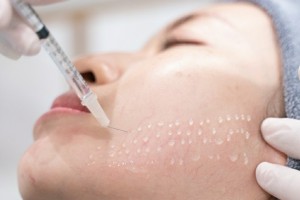 Tiêm căng bóng trẻ hoá da có bị biến chứng không?