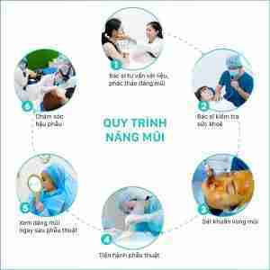 nâng mũi cấu trúc nâng mũi cấu trúc