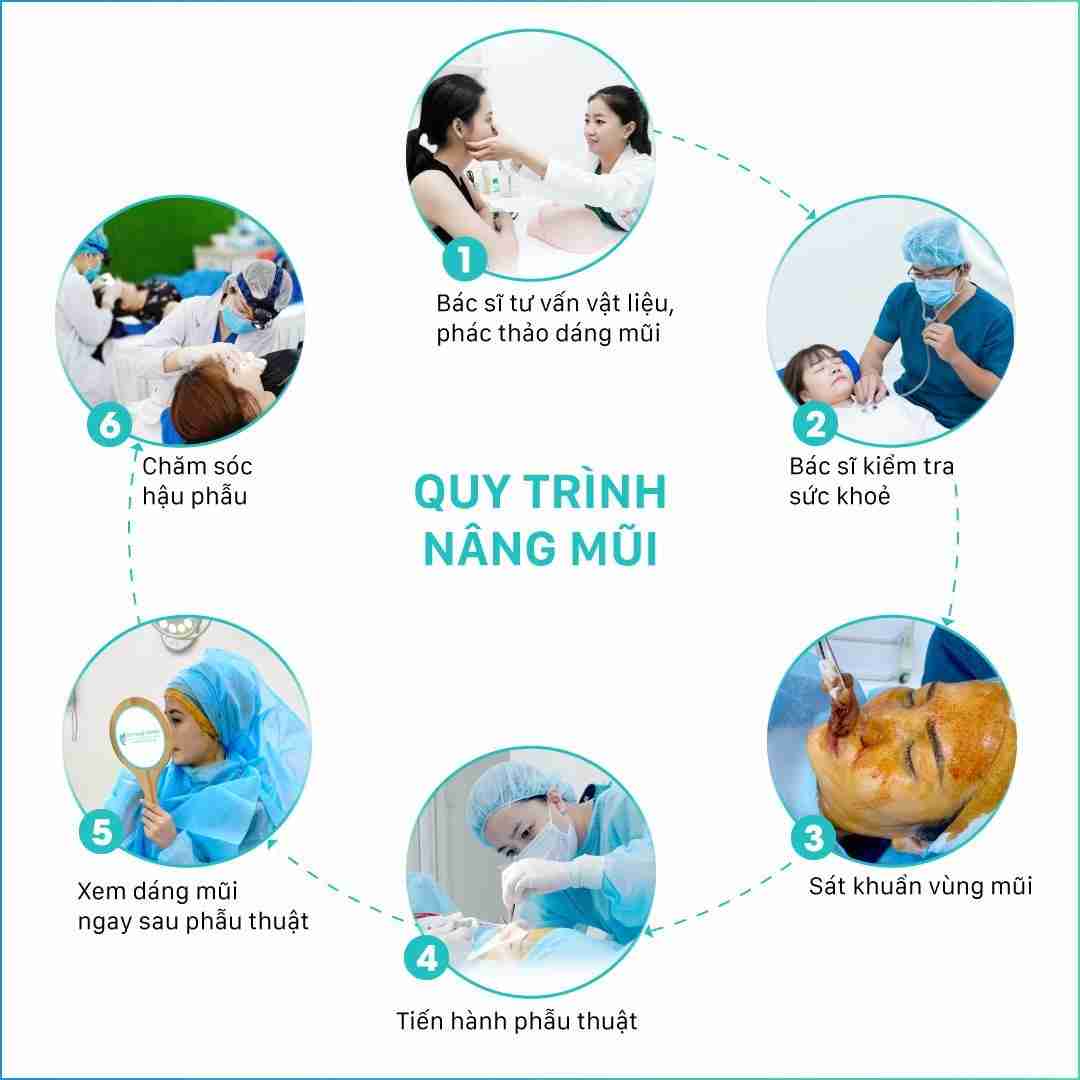 nâng mũi cấu trúc nâng mũi cấu trúc