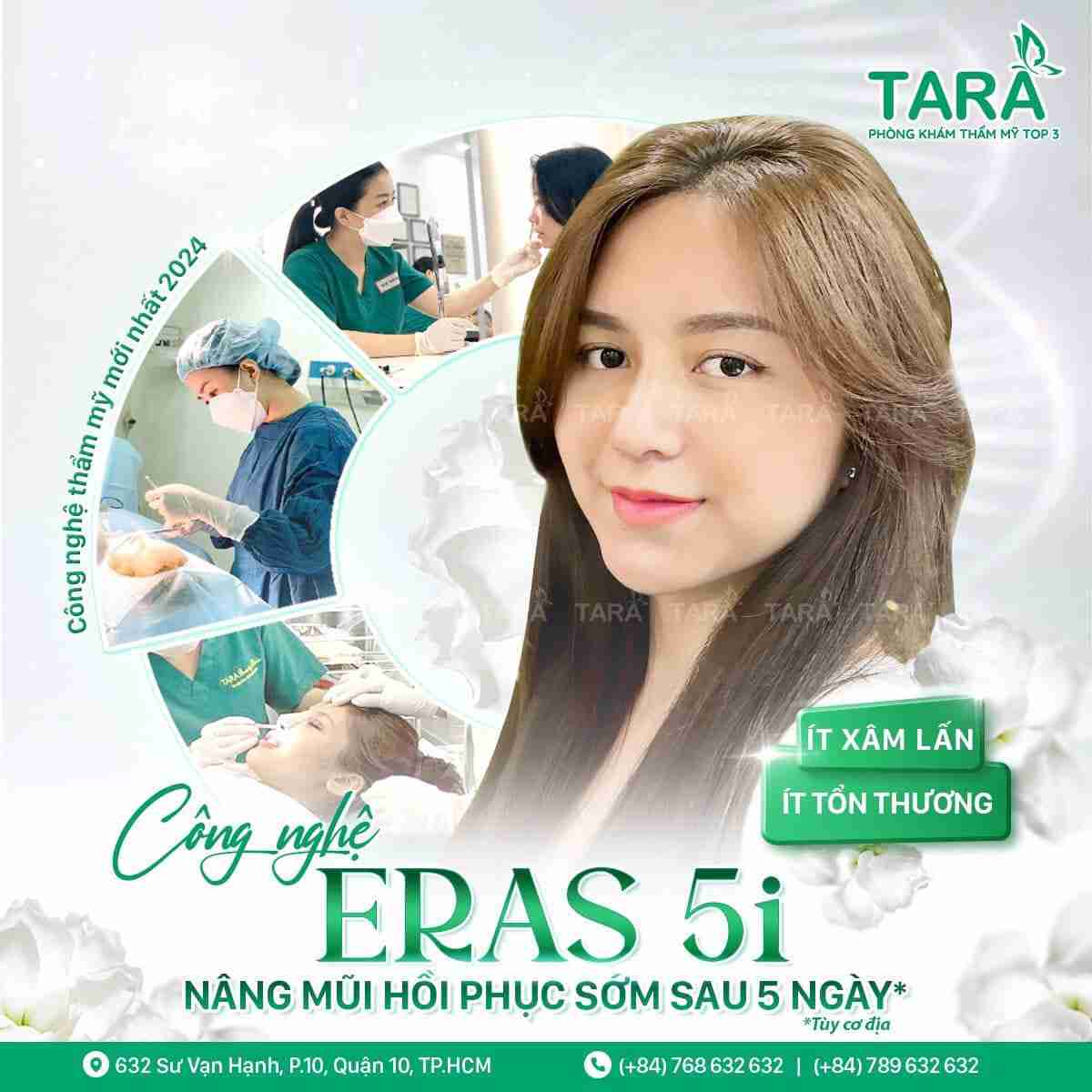 Nâng mũi sống surgiform Nâng mũi sống surgiform