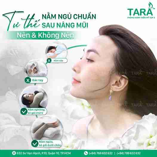 nâng mũi sụn sườn