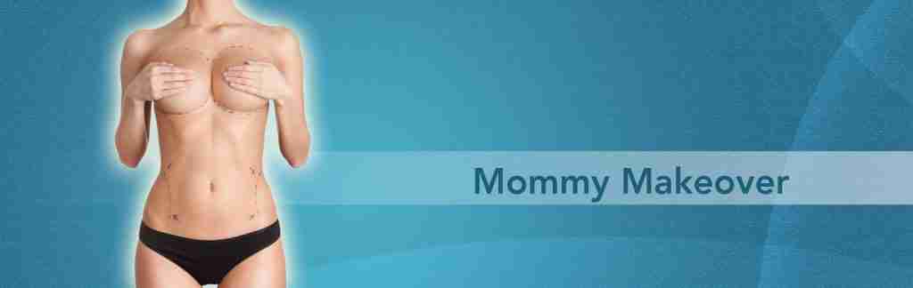 mommy makeover