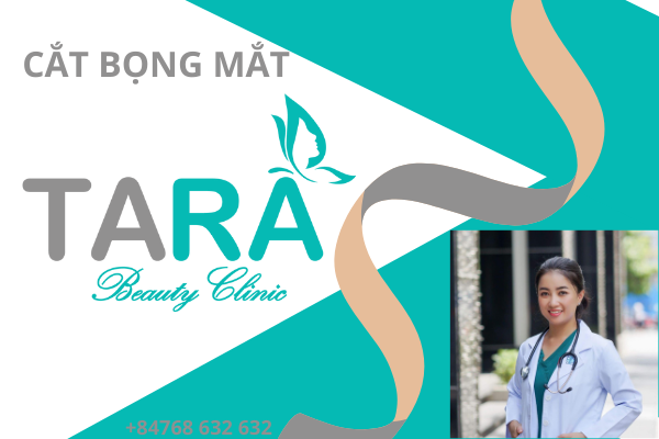 phẫu thuật bọng mắt
