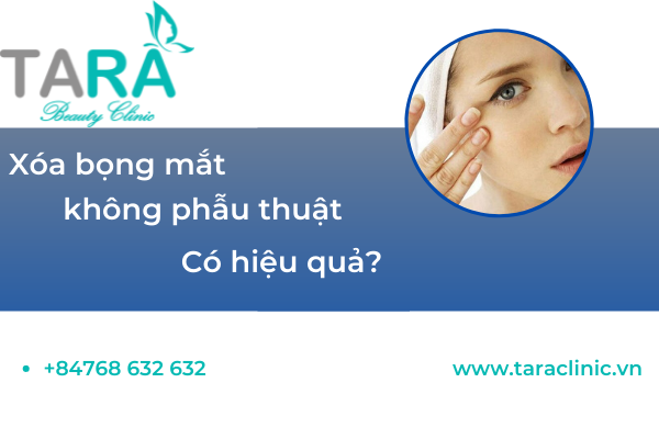 xóa bọng mắt không phẫu thuật