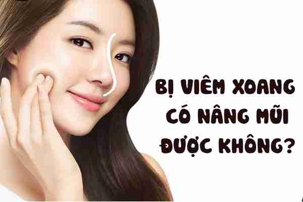 bị viêm xoang có nâng mũi L-Line được không