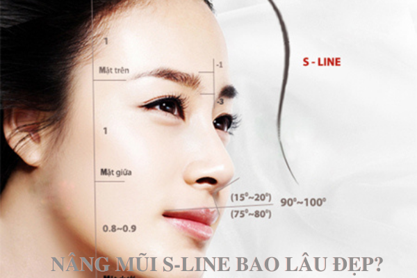 nâng mũi S-line bao lâu thì đẹp