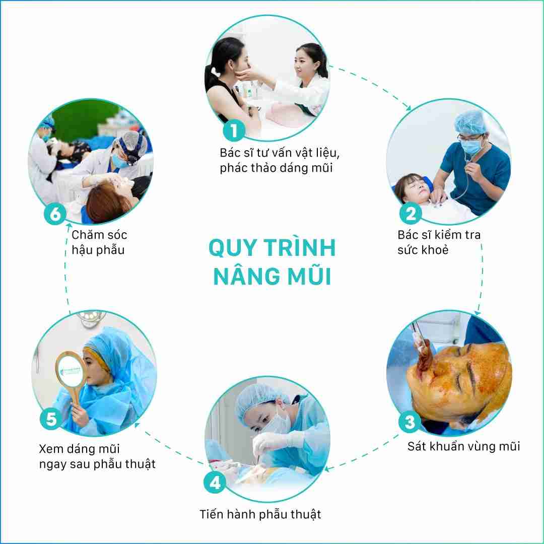 quy trình nâng mũi tại tara beauty clinic