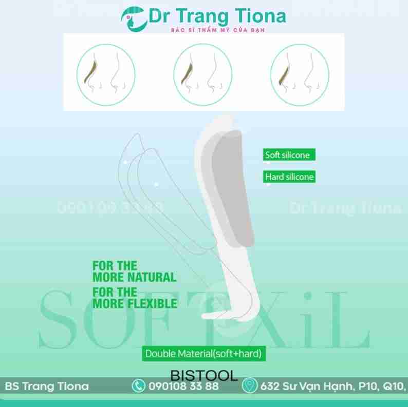 nâng mũi sụn softxil