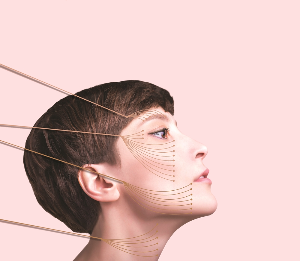 nâng cơ vùng má chảy xệ