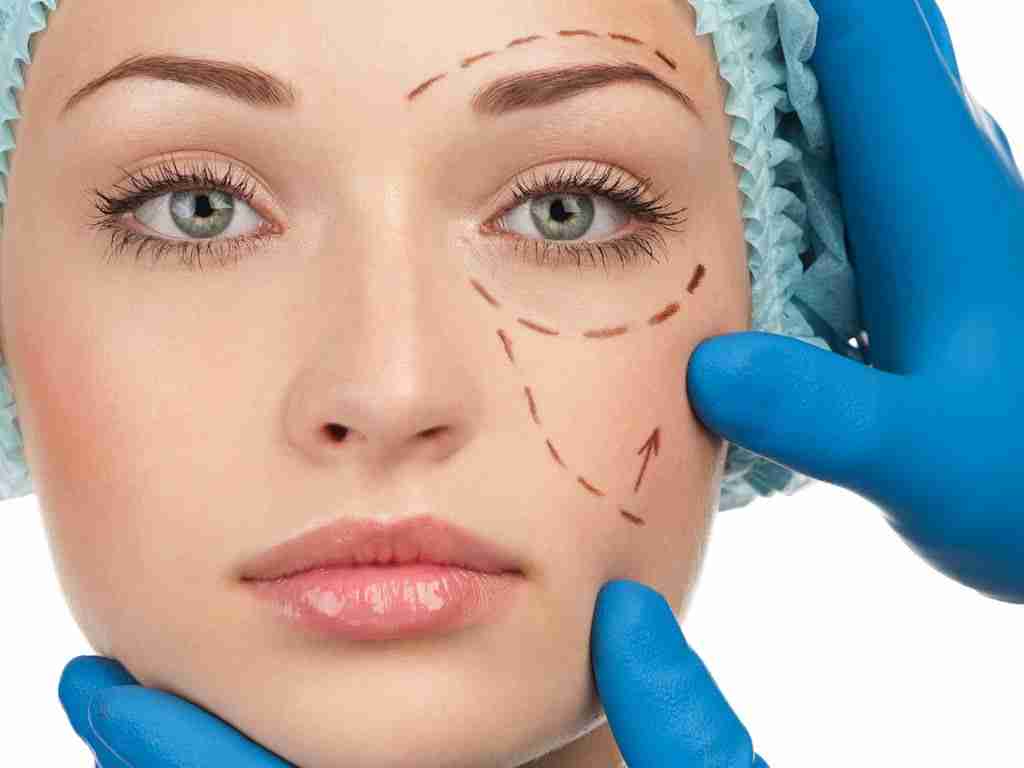 nâng cơ vùng má chảy xệ