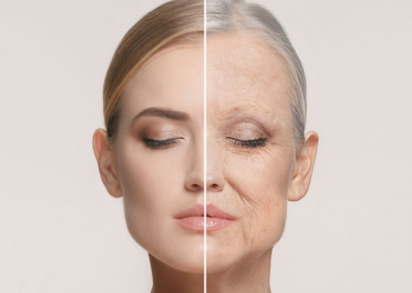 Nâng cơ vùng má chảy xệ