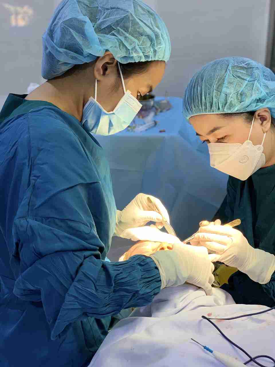 xóa rãnh lệ bằng phẫu thuật thẩm mỹ