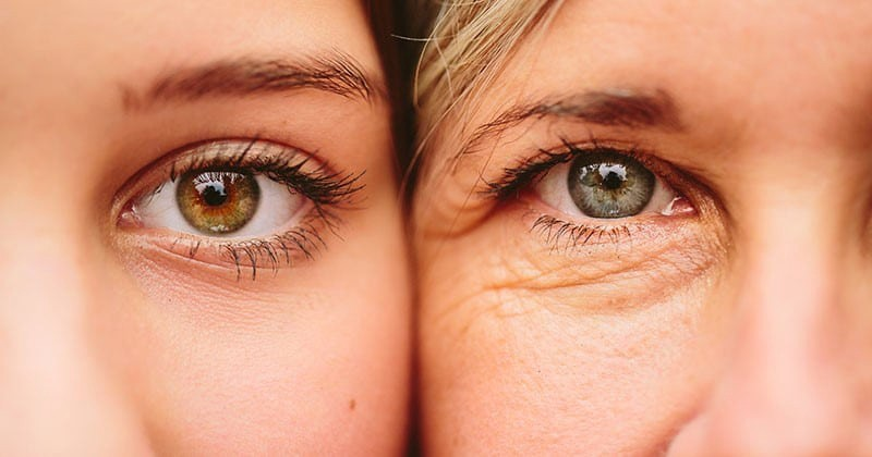 xóa rãnh lệ bằng phẫu thuật thẩm mỹ