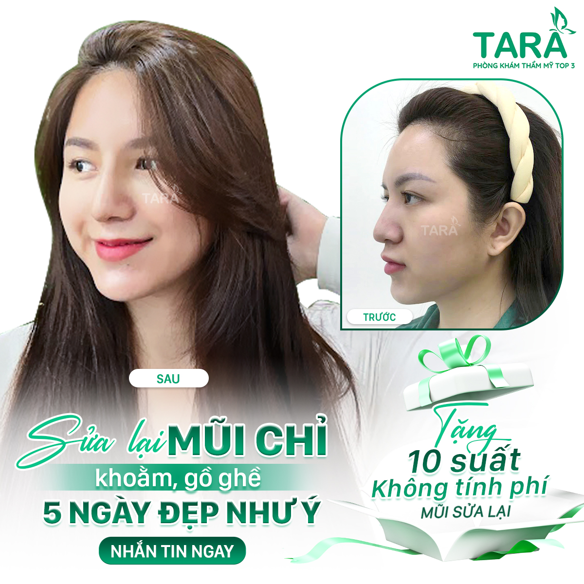 Địa chỉ nâng mũi uy tín tại tphcm