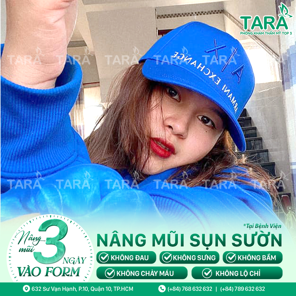 Địa chỉ nâng mũi uy tín tại tphcm