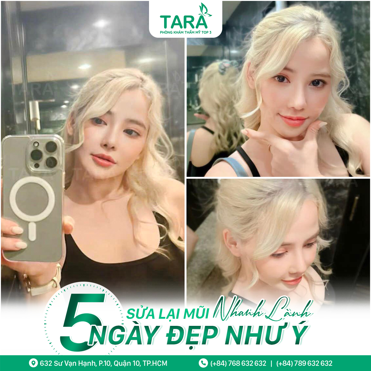 Địa chỉ nâng mũi uy tín tại tphcm