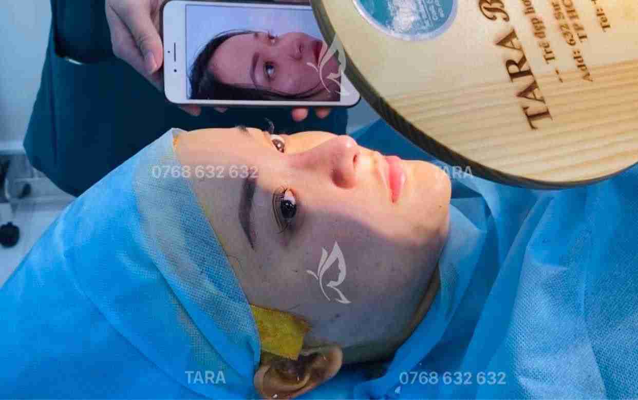 sửa mũi có đau không