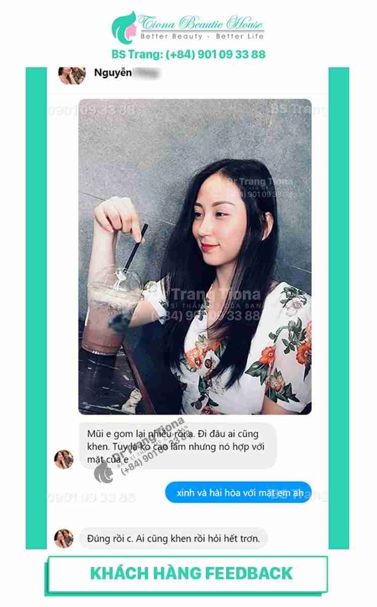 Sửa mũi diều hâu
