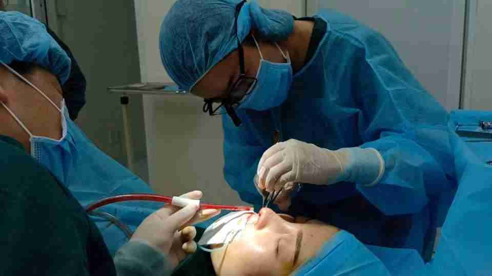 nâng mũi cấu trúc Surgiform