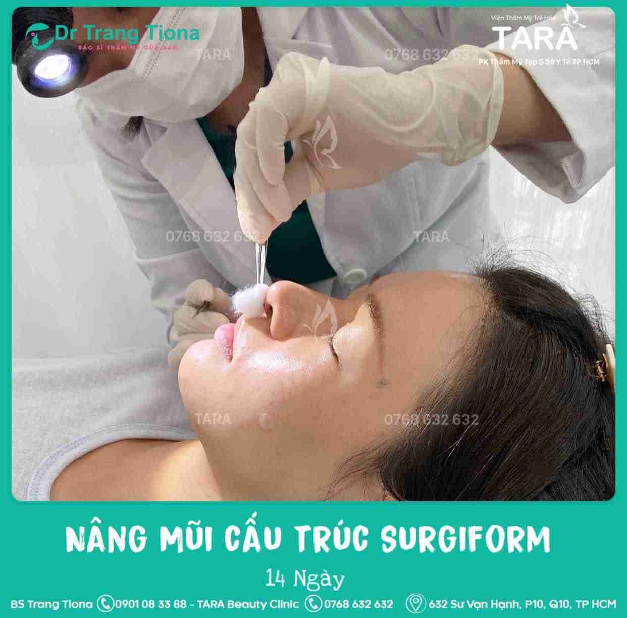 Sửa mũi bao lâu thì đẹp tự nhiên