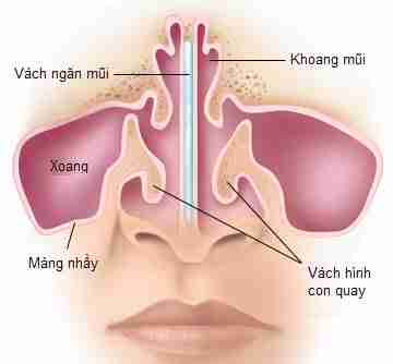 Ưu và nhược điểm của các loại sụn tự thân trong nâng mũi