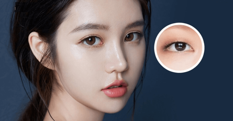 Quy trình 8 bước cắt mí bác sĩ Trang: Đẹp và An toàn