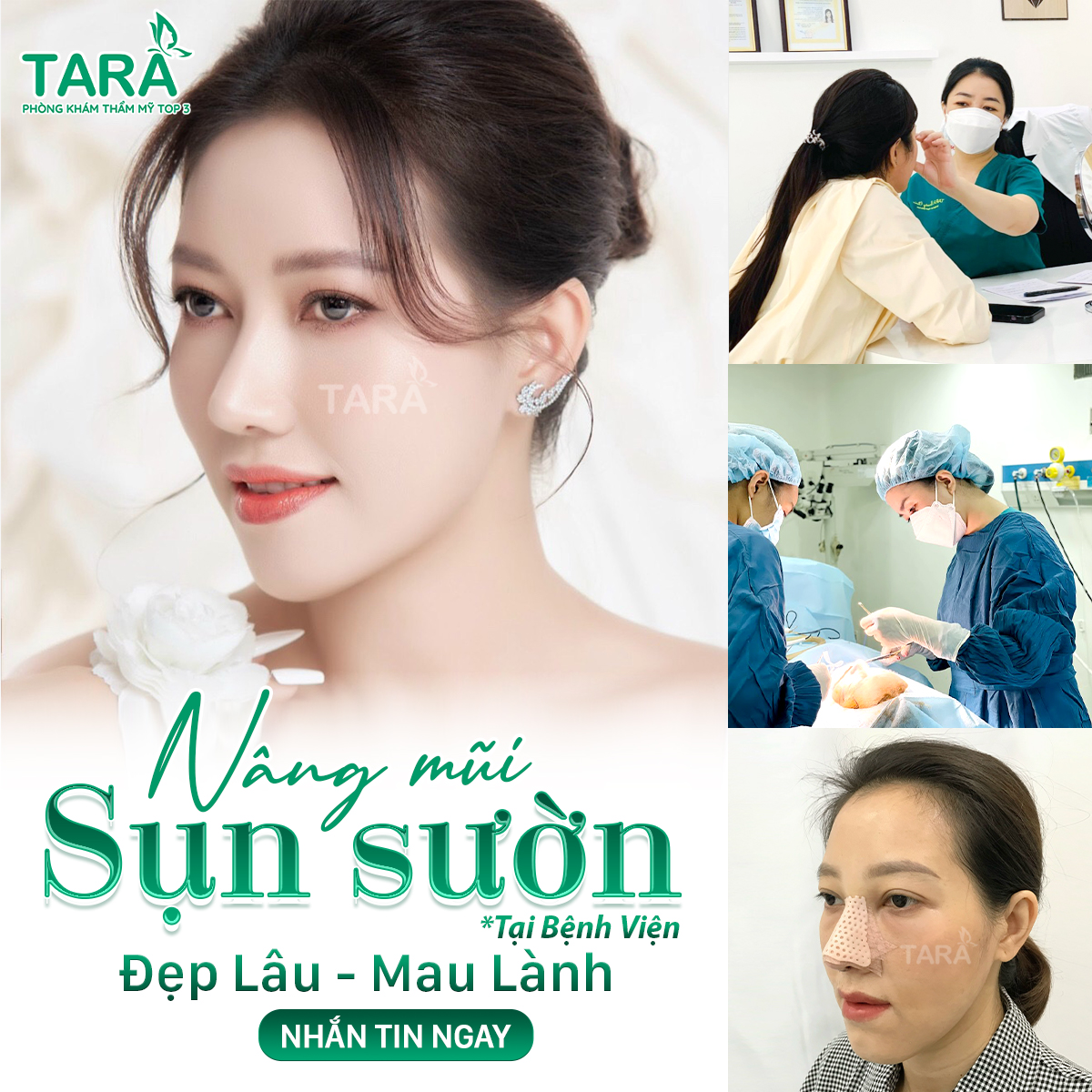 Bác sĩ nâng mũi giỏi tphcm