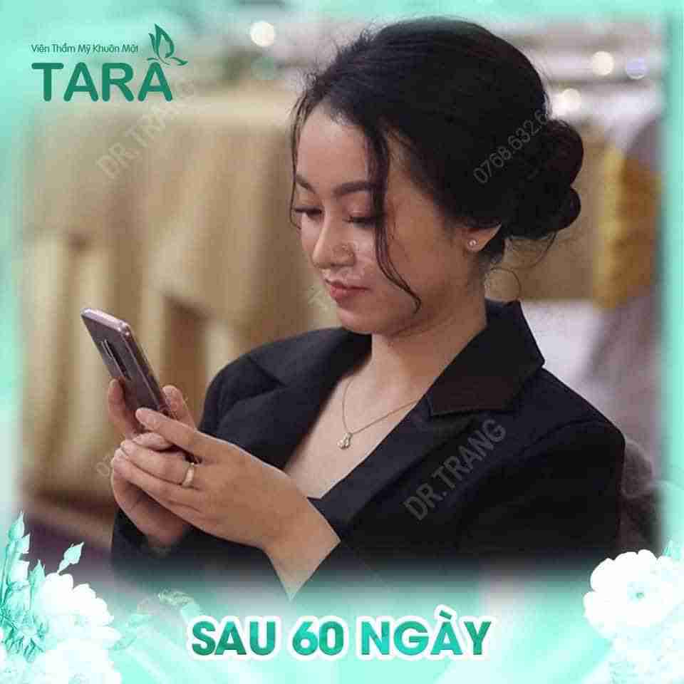 Nâng mũi có để lại di chứng phẫu thuật không