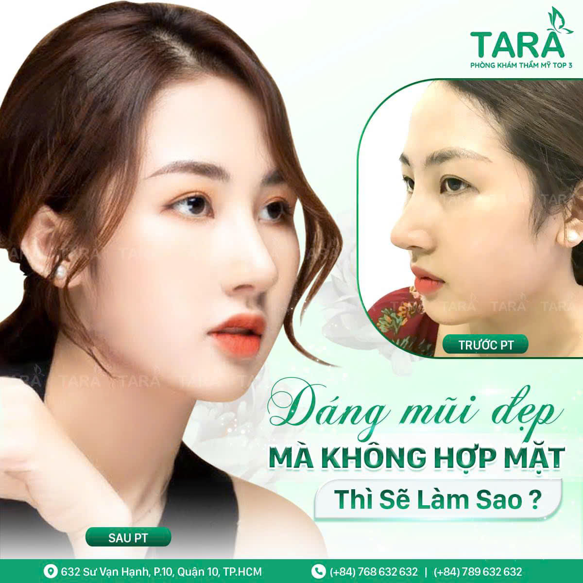 Địa chỉ nâng mũi uy tín tại tphcm