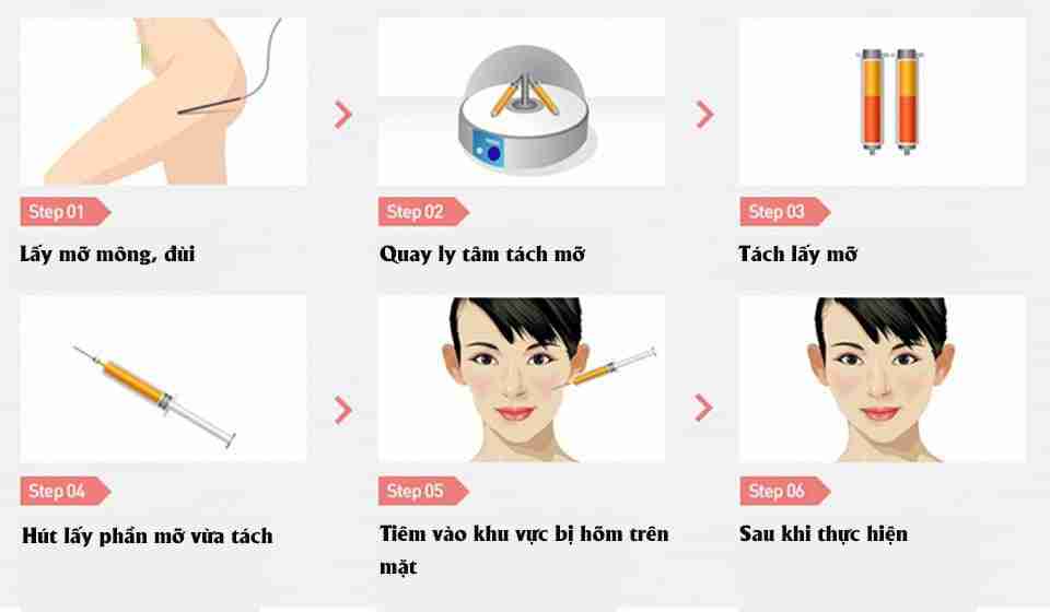Cấy mỡ mặt Babyface bao lâu thì được trang điểm?