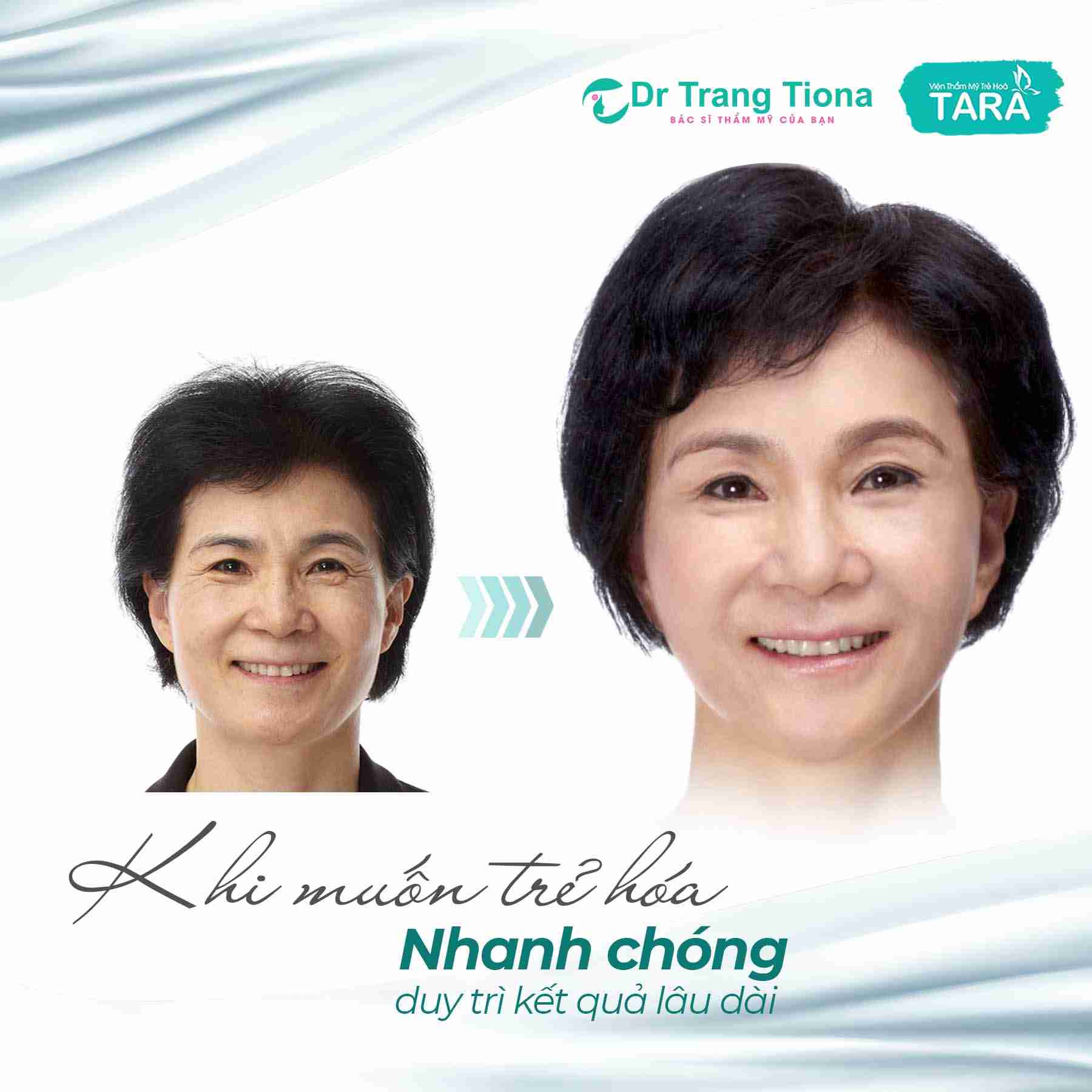Phẫu thuật căng da Midface thực hiện như thế nào?
