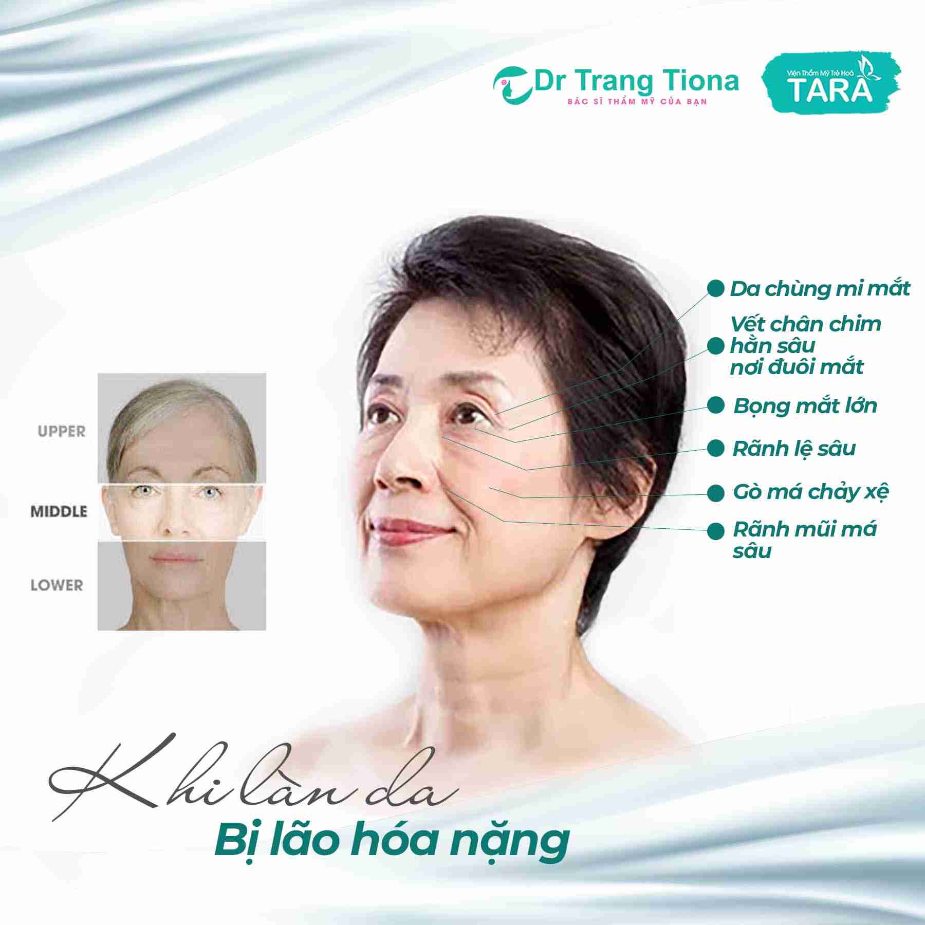 phẫu thuật căng da mặt