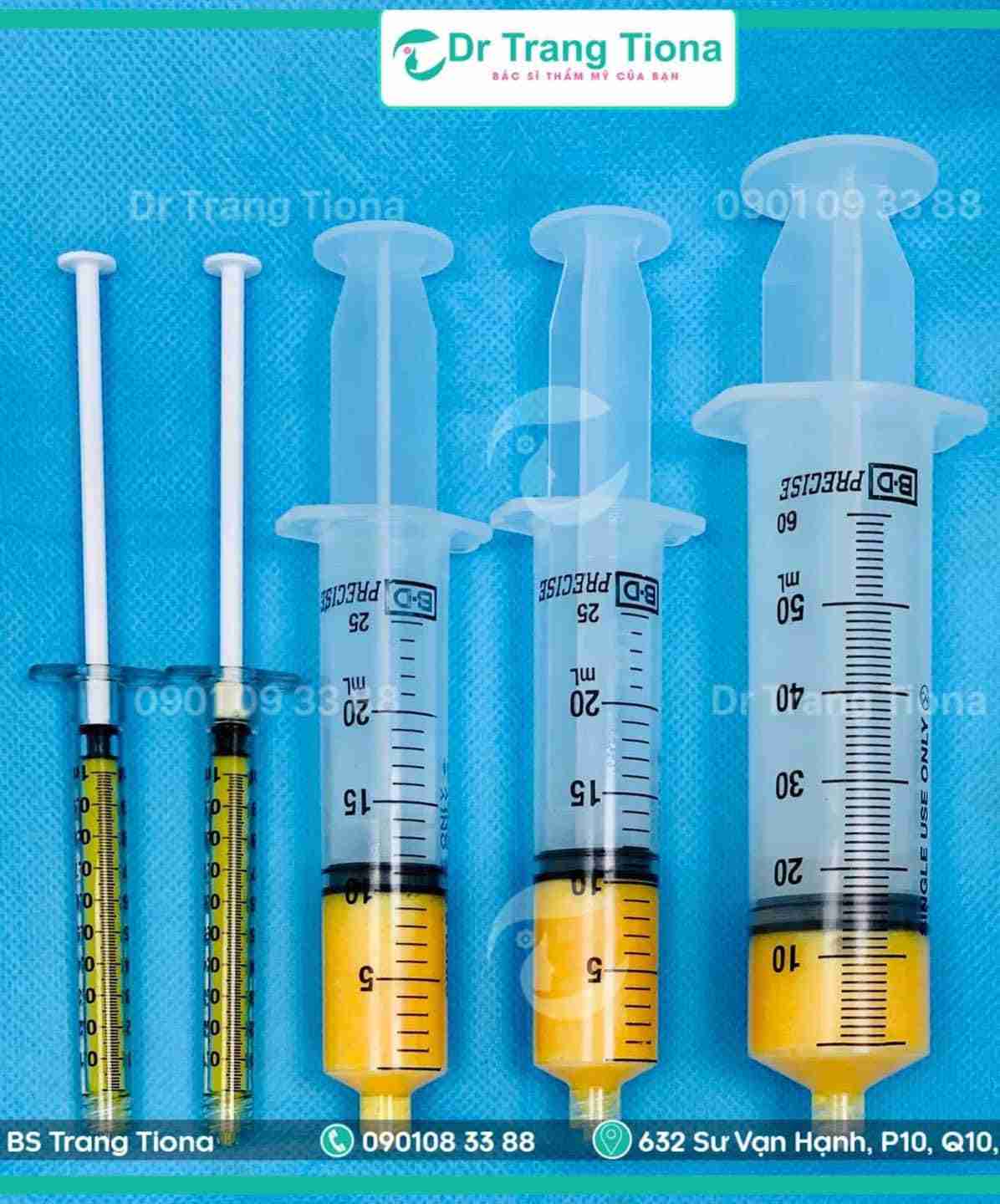 Nên căng da mặt hay cấy mỡ mặt điều trị lão hóa
