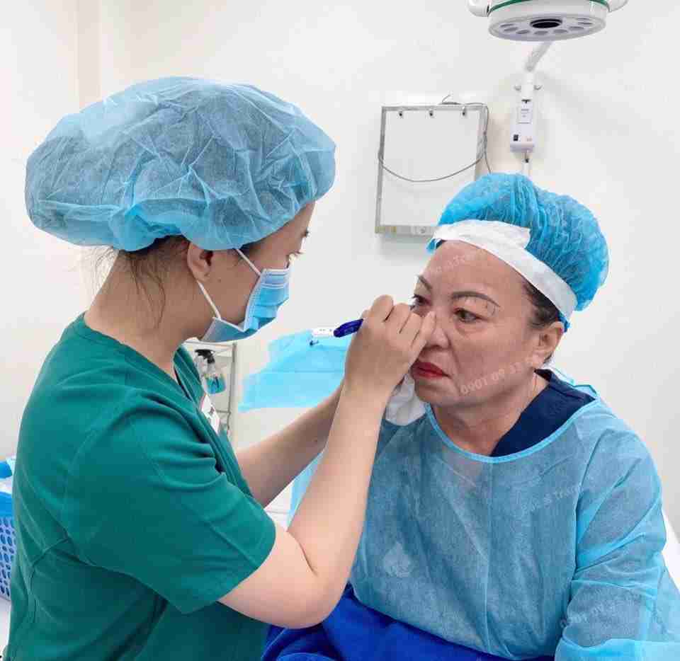 Phẫu thuật căng da mặt Midface bao lâu thì đẹp tự nhiên