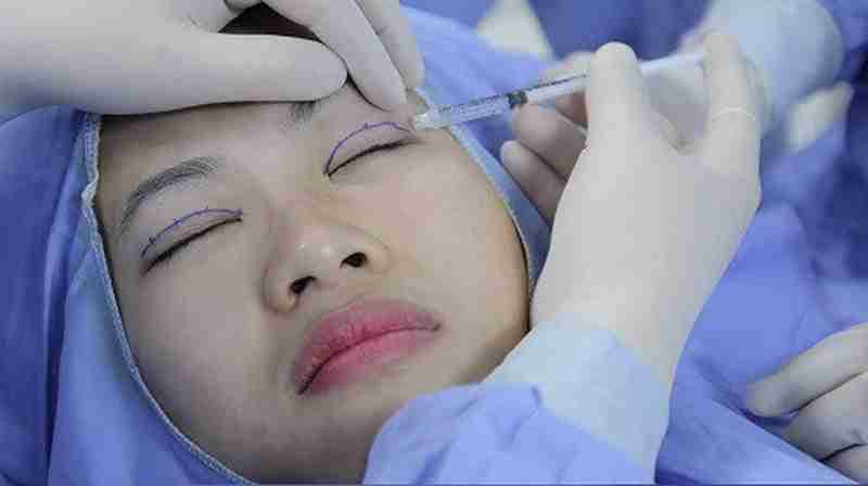 Cắt mí mắt có đau không