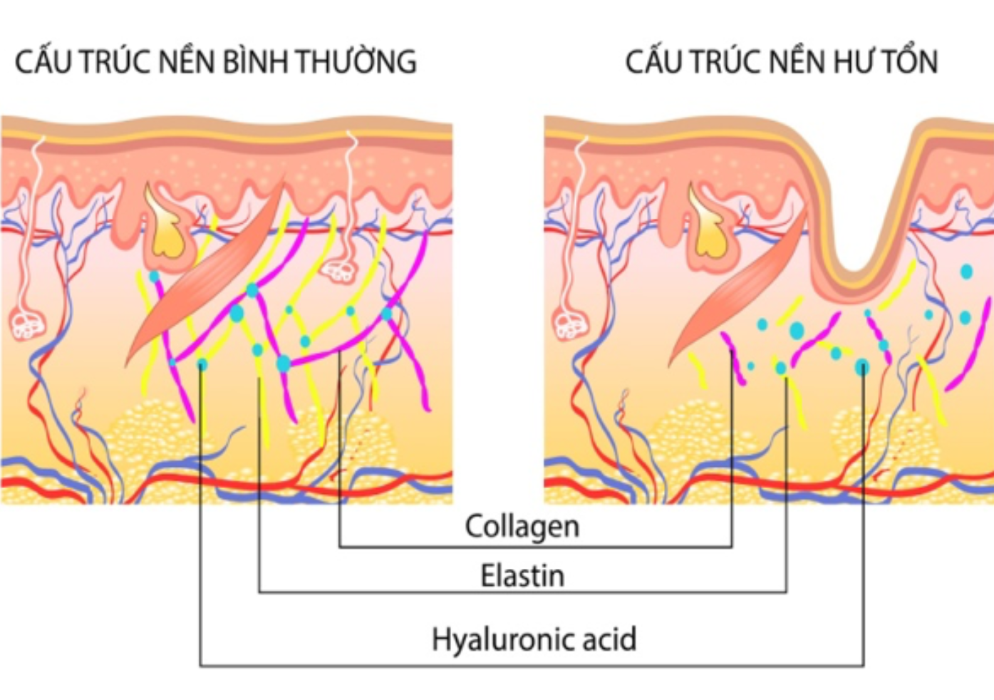 Những thói quen tai hại khiến gương mặt trông già hơn