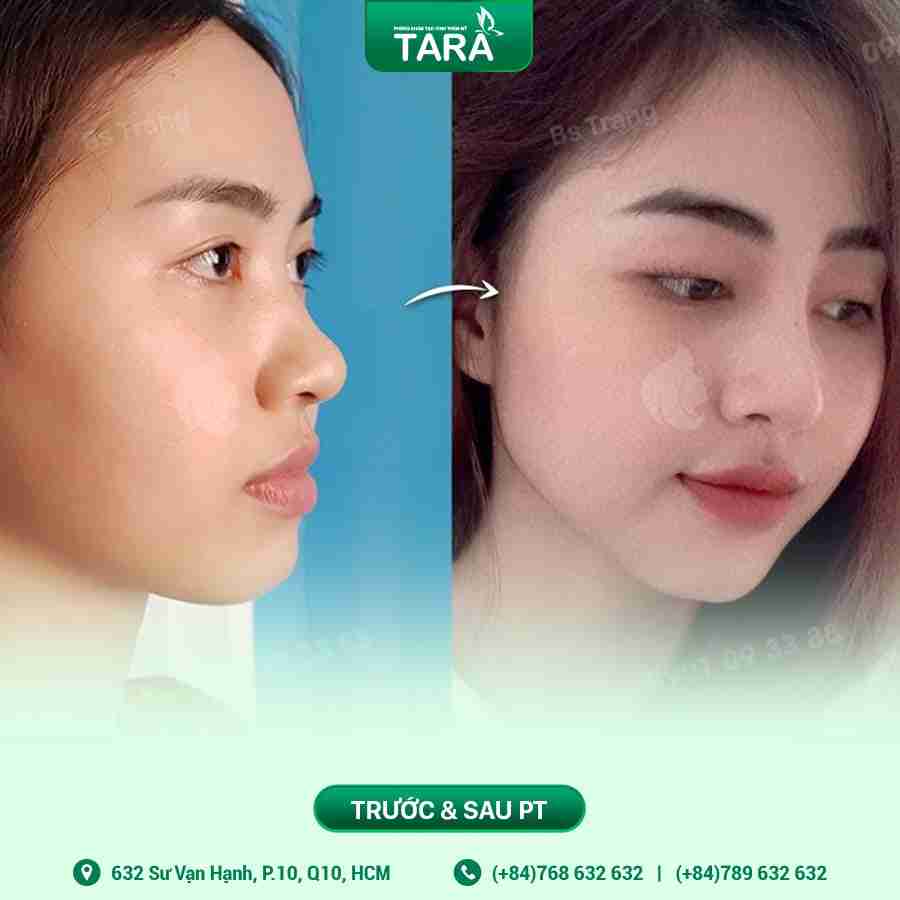 7 yếu tố nhận biết thẩm mỹ viện nâng mũi uy tín  