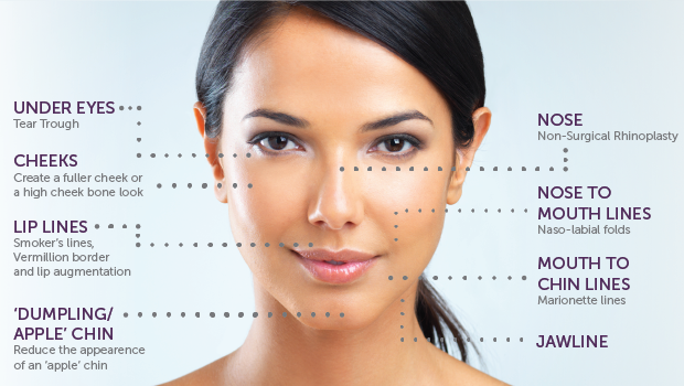 Hiểu về đúng về tiêm filler trong thẩm mỹ làm đẹp