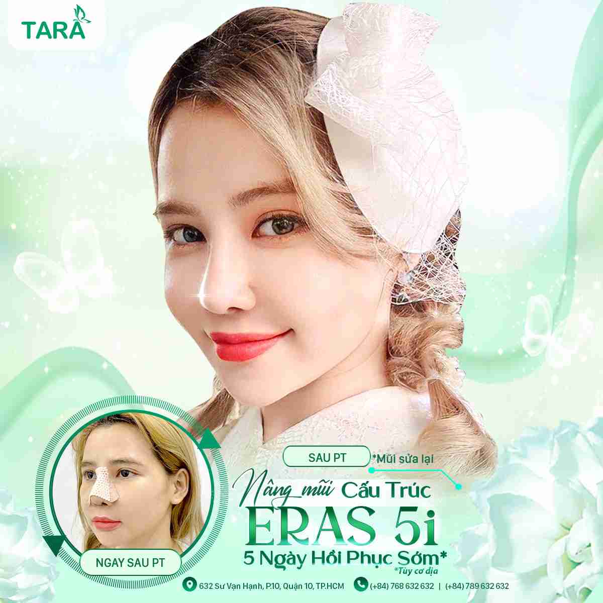 sửa mũi hỏng