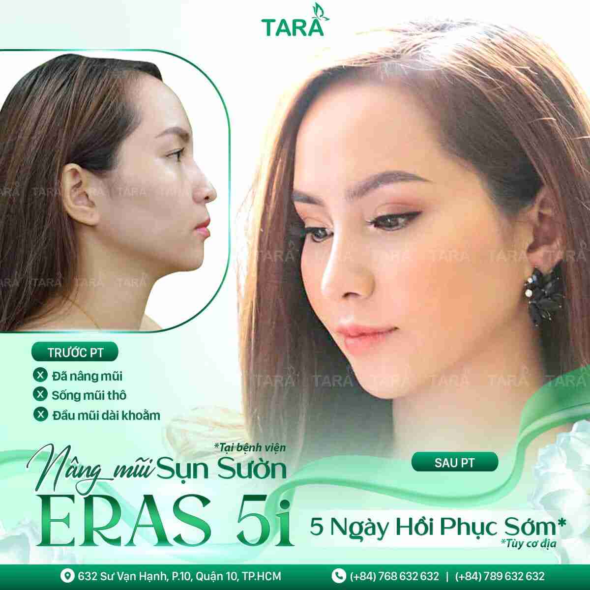 giá sửa mũi hỏng