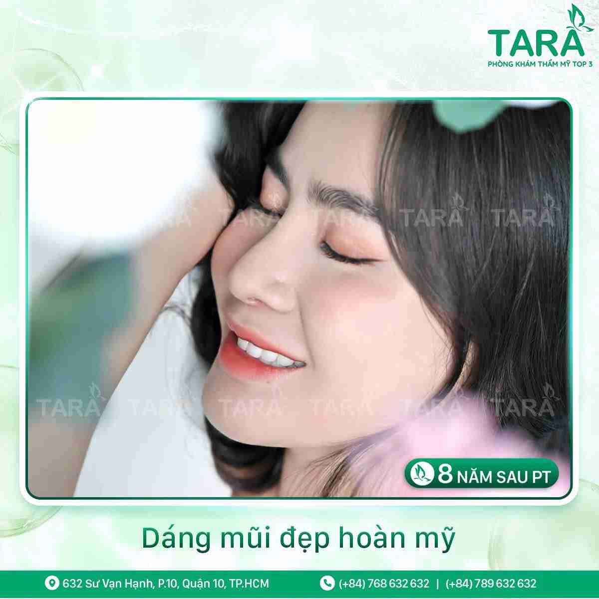 Tư vấn nâng mũi sụn tự thân cho da mũi mỏng