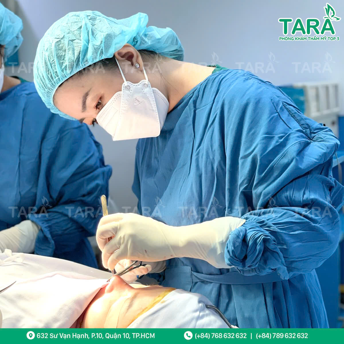 Địa chỉ nâng mũi uy tín tại tphcm