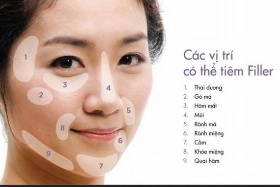 Tổng hợp các câu hỏi về tiêm trẻ hoá tạo hình khuôn mặt 