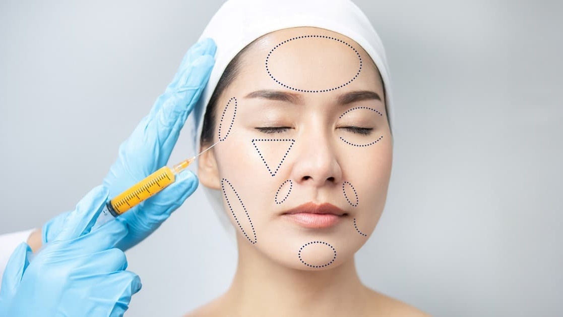Trước khi căng da mặt toàn phần cần phải lưu ý gì?