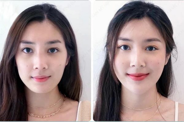 HA dạng định hình có liên kết chéo.