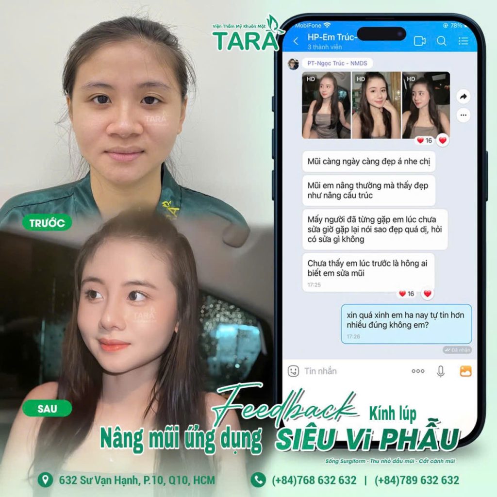 TS.BS Trang: "Không phải cứ nâng mũi cao là đẹp"