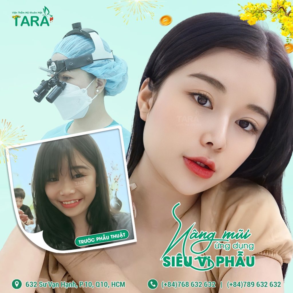 Phân biệt nâng mũi siêu vi phẫu và nâng mũi thường