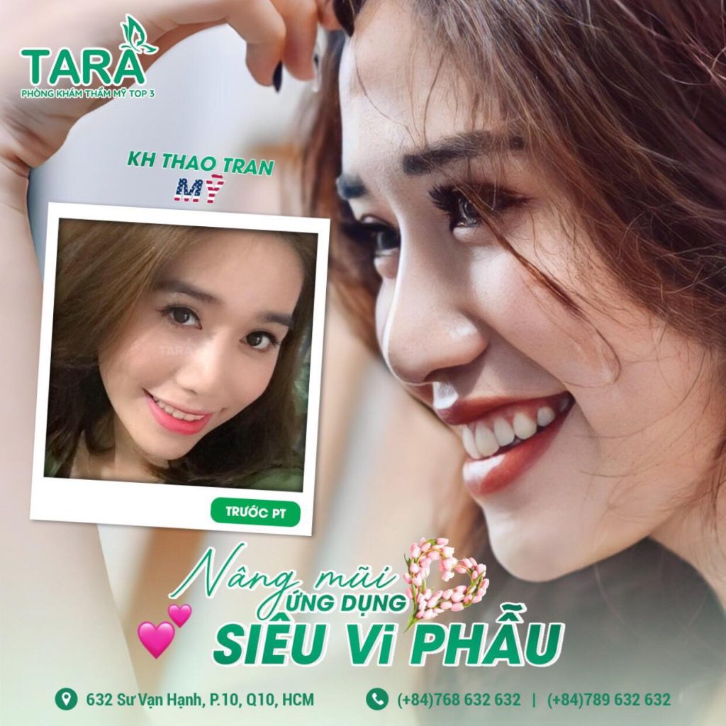 Phân biệt nâng mũi siêu vi phẫu và nâng mũi thường