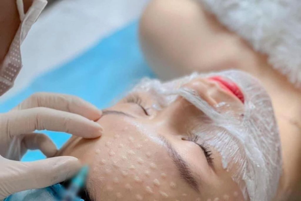 HA là gì? Cơ chế của HA trong cấp ẩm và tiêm trẻ hóa tạo hình khuôn mặt