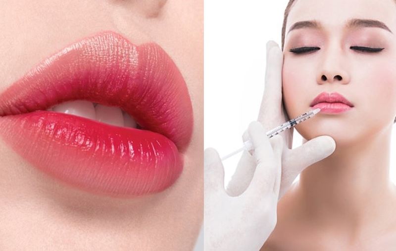 HA là gì? Cơ chế của HA trong cấp ẩm và tiêm trẻ hóa tạo hình khuôn mặt